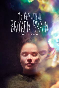 My Beautiful Broken Brain Torrent - WEB-DL 720p/1080p Dual Áudio